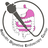 Endoeasy channel