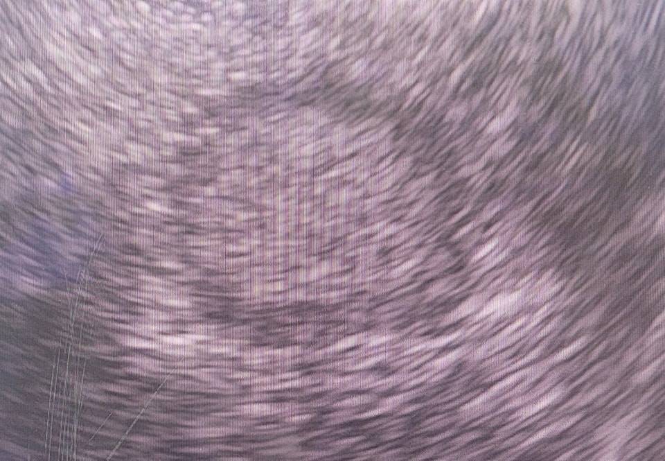 EUS-FNA/B model photo